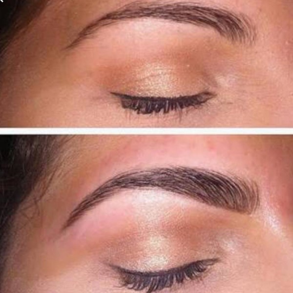 Brow Treatment